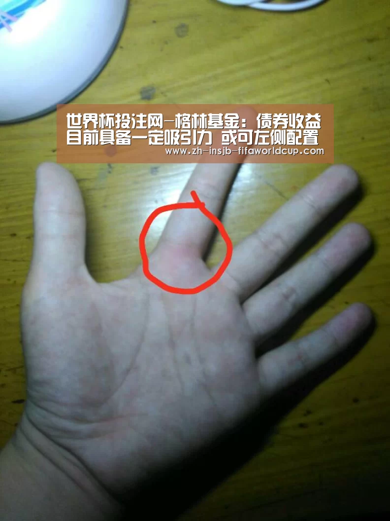 世界杯投注网-格林基金:债券收益目前具备一定吸引力 或可左侧配置(图3) 世界杯投注网