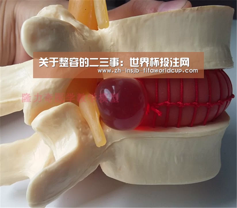 关于整容的二三事:世界杯投注网(图2) 世界杯投注网